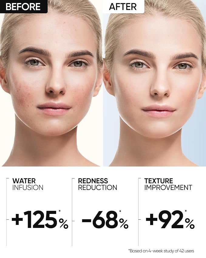 Reduce Redness-Truffle Biome