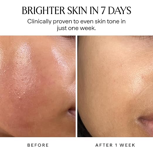 Nova Serum