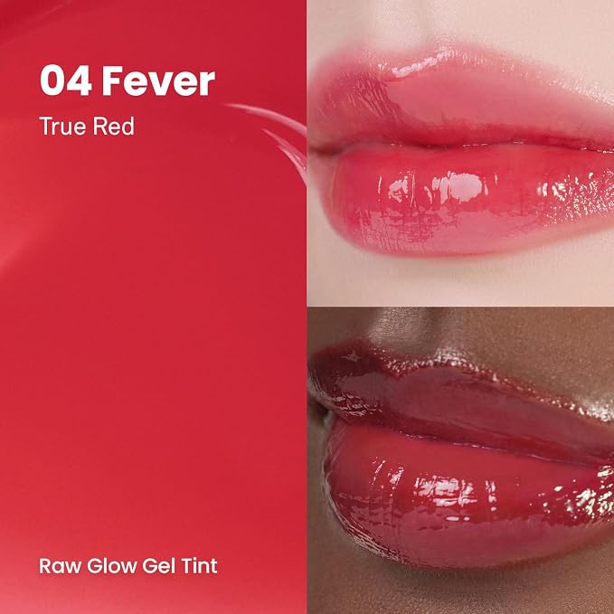 FEVER