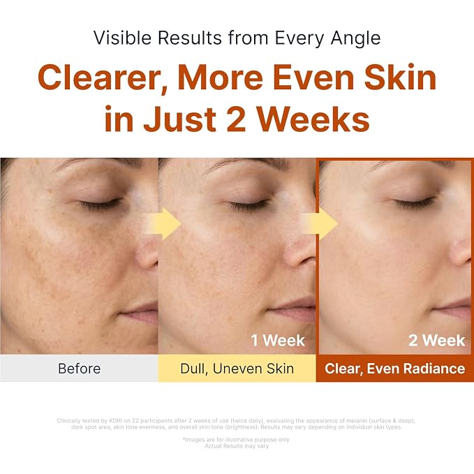 Kojic Acid