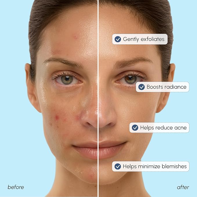 Glycolic Acid