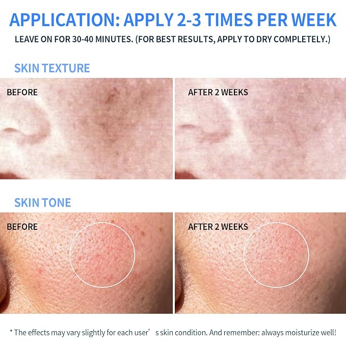 Brightening Mask