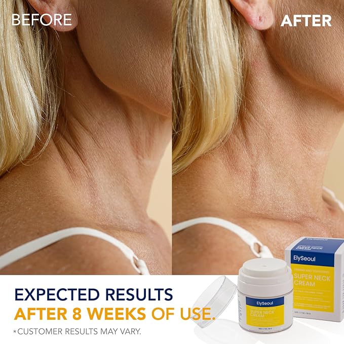 Neck Cream
