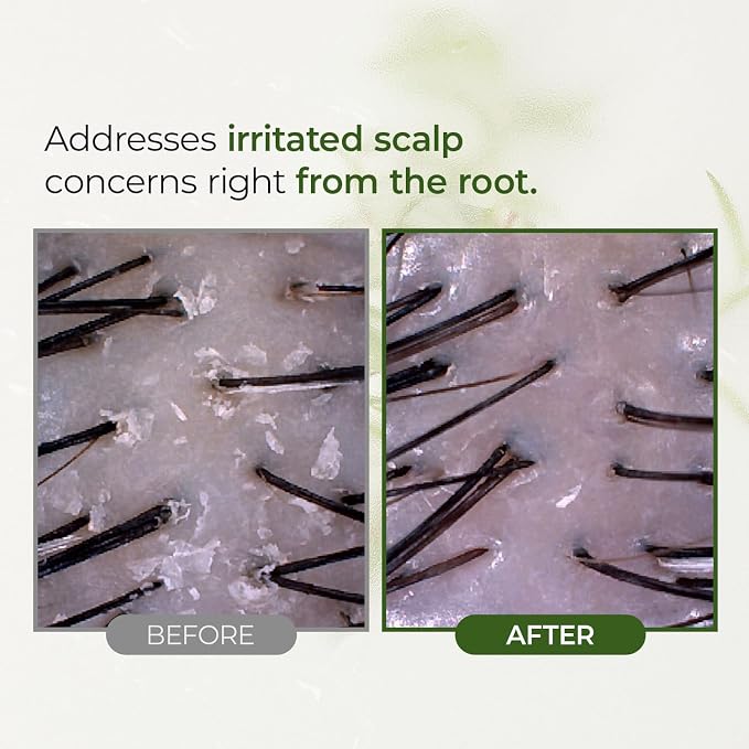 Tea Tree Scalp Water Scaler Full Size, 8.45 fl oz
