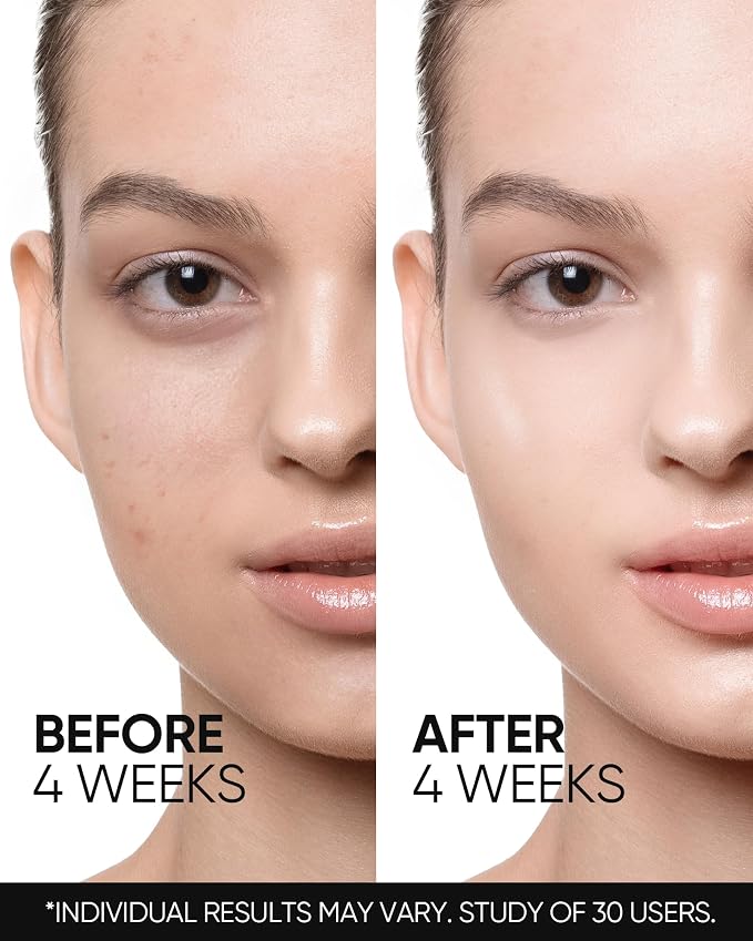 Retinol