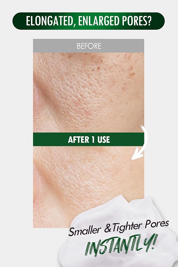 Pore Zero