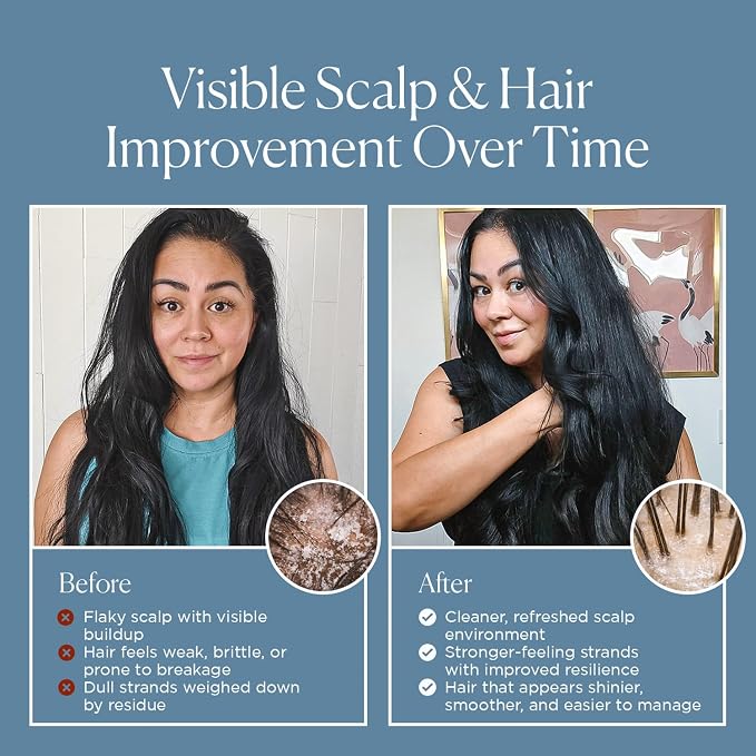 Blue Label Shampoo For Dry/Brittle Hair