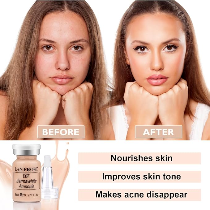 Natural