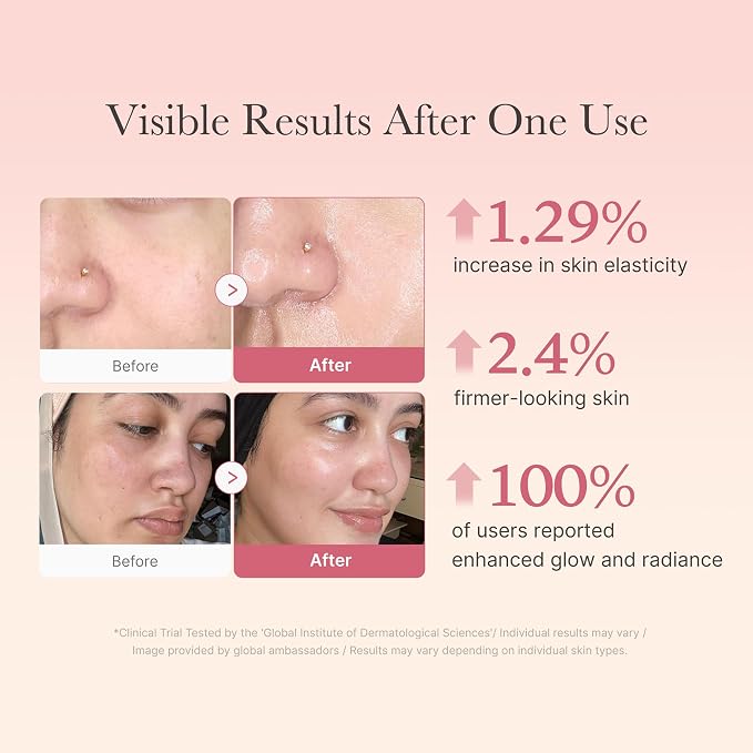 Collagen