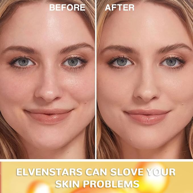 Vitamin C.1