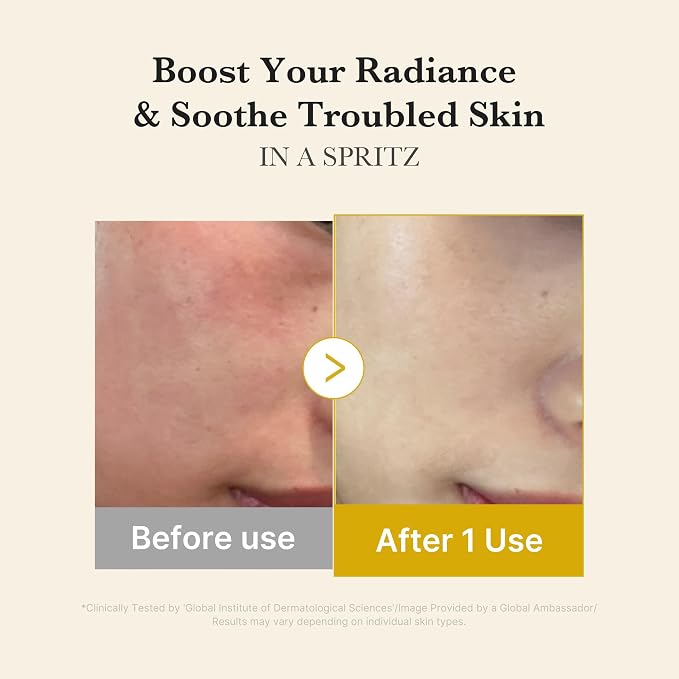 Kojic Acid Turmeric