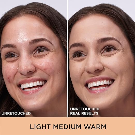 11W Light Medium Warm (light with yellow undertones)