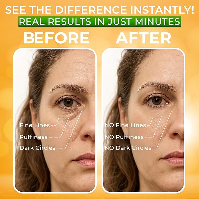 __DEFAULT__