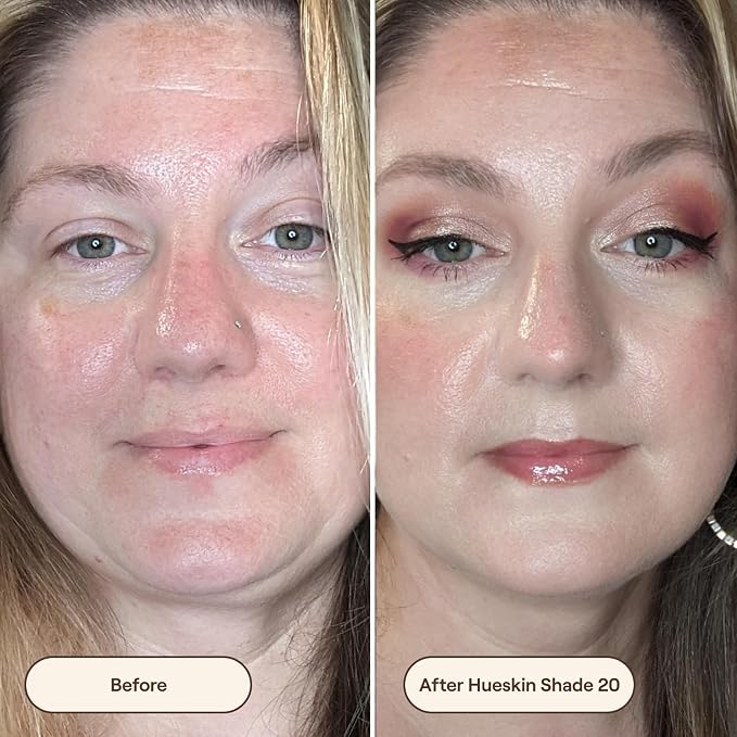 20 - Light (Neutral Undertone)