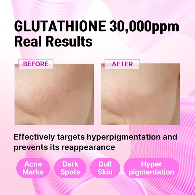 Glutathione