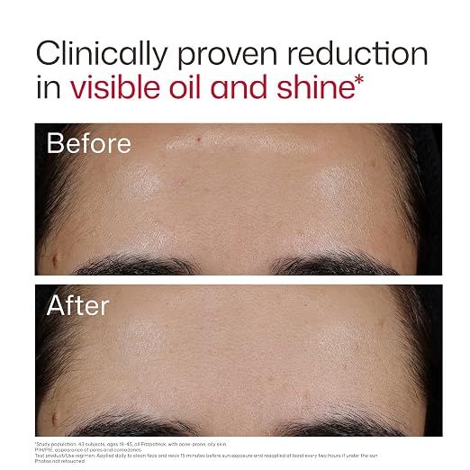 01 - New Blemish Prone (1.7 oz)