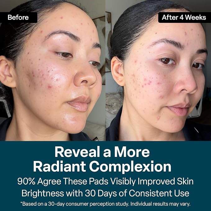 20% Glycolic Acid