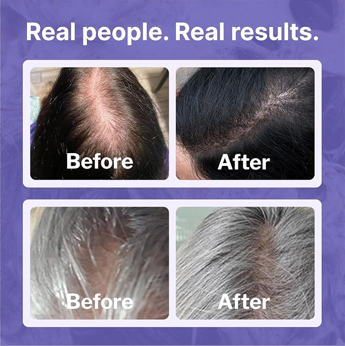 Women's Regrowth Kit