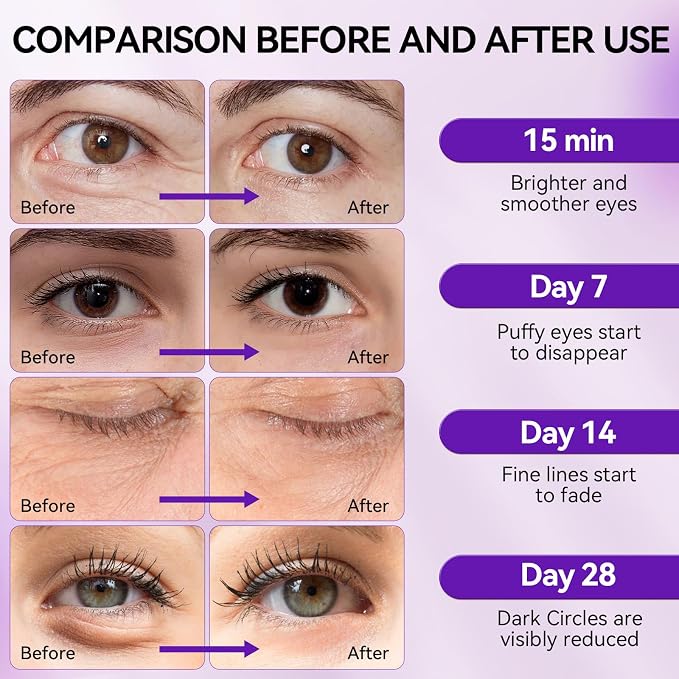 Retinol purple