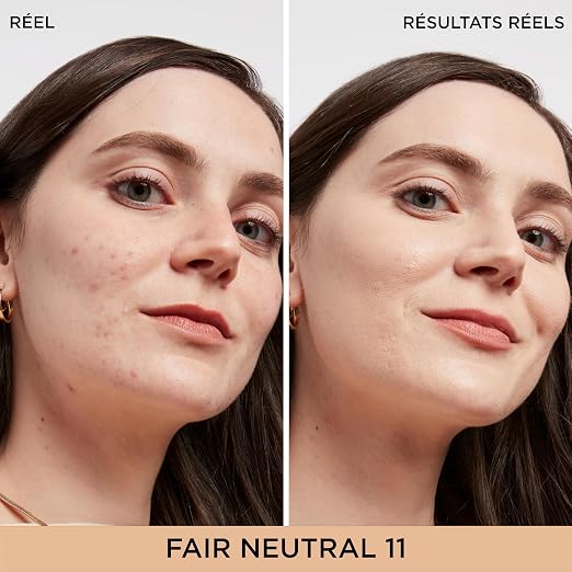 11 Fair Neutral (fair complexion with neutral undertone)