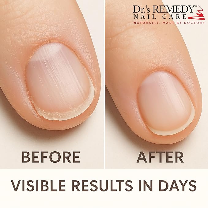 Nourish Nail Serum