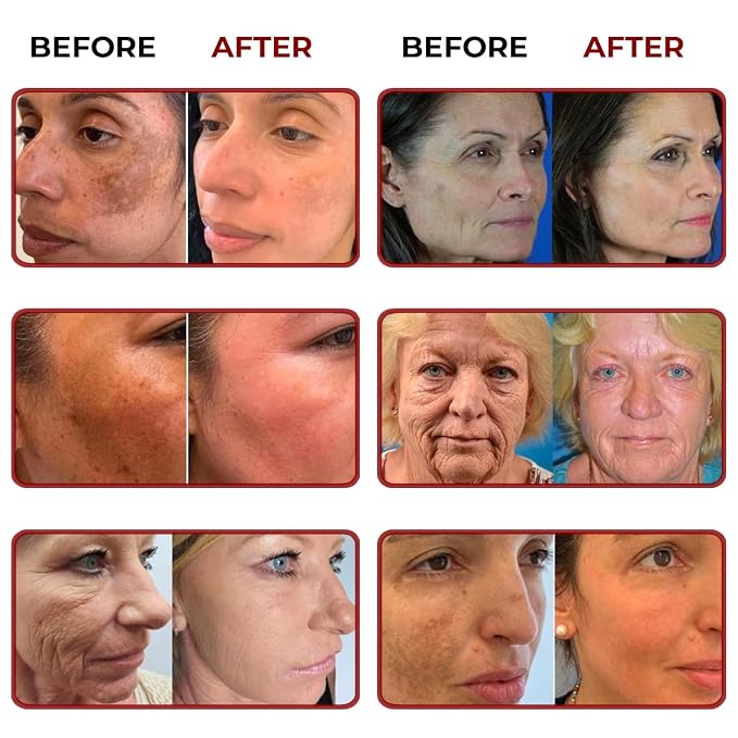 B2. 2 Boxes + Grapefruit Hair Regrowth Serum