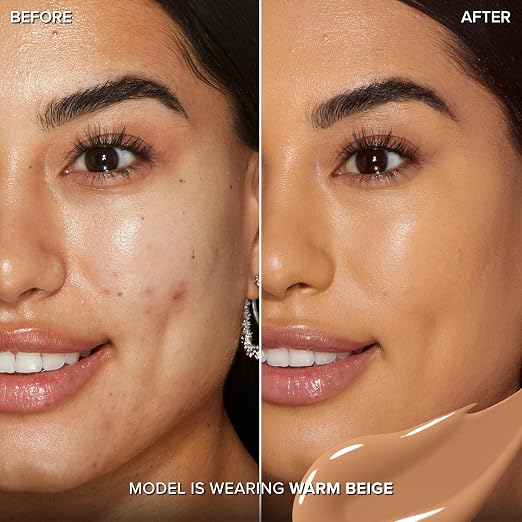 15 Warm Beige (Medium with Neutral Undertones)