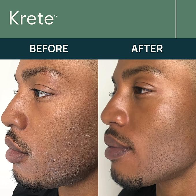 Probiotic Cleanser + Facial Serum