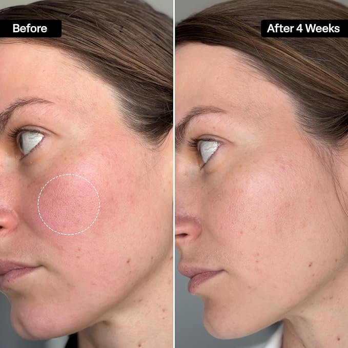 __DEFAULT__