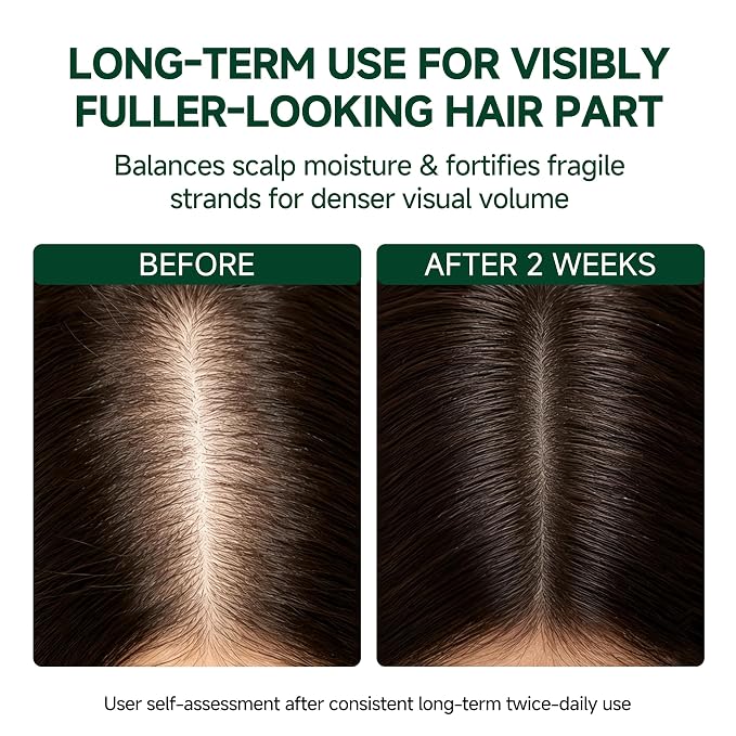 Roll‑On Serum