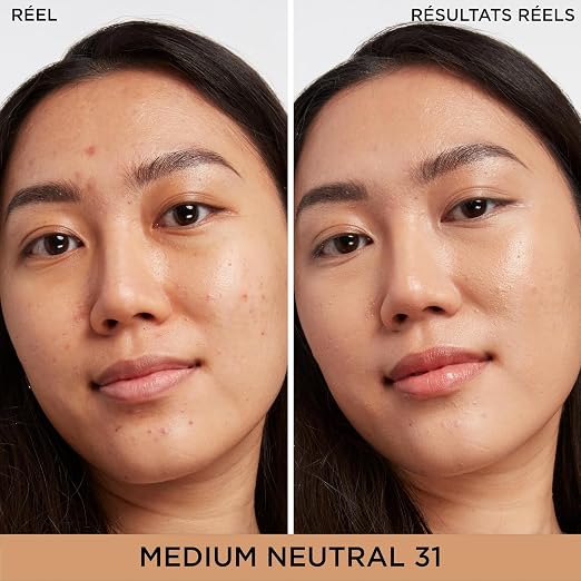 31 Medium Neutral (medium complexion with neutral undertone)