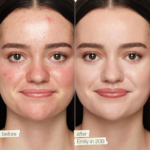 20B light (light skin with cool, pink undertones)