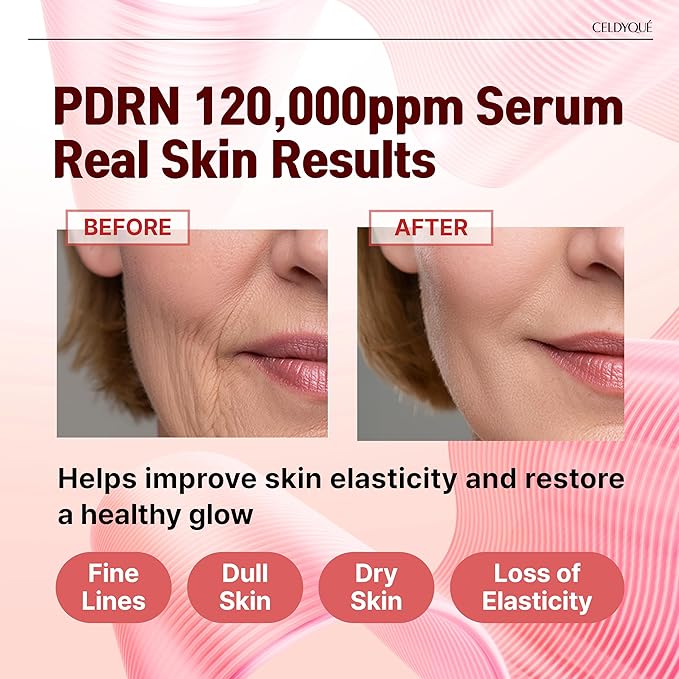 PDRN 12%