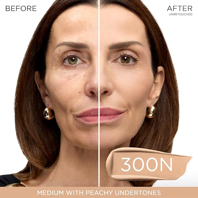 300N - Medium with Peachy Undertones