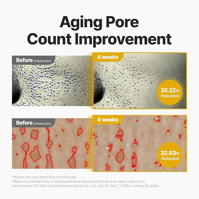 Retinoid Yellow