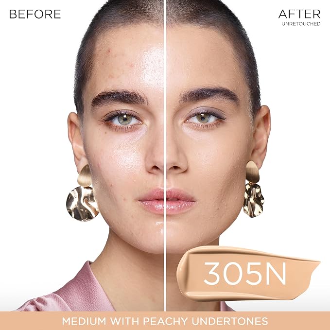 305N - Medium with Peachy Undertones