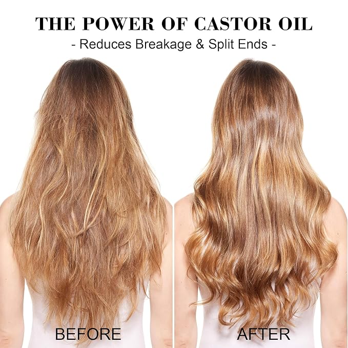 Castor Oil