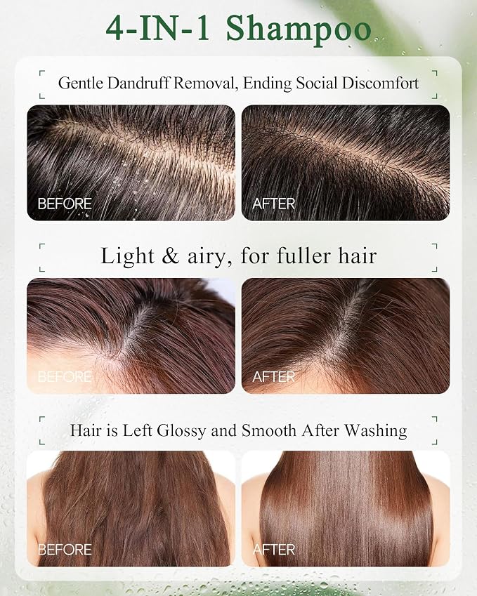 Shampoo