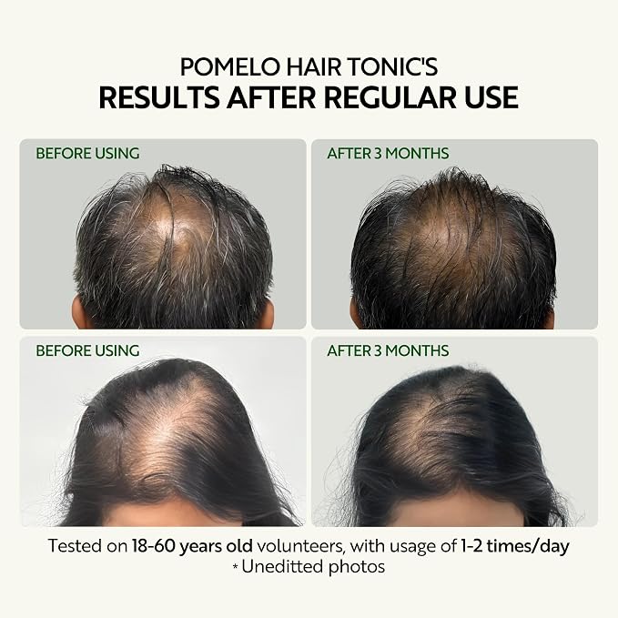 Hair Tonic 4.73 Fl oz