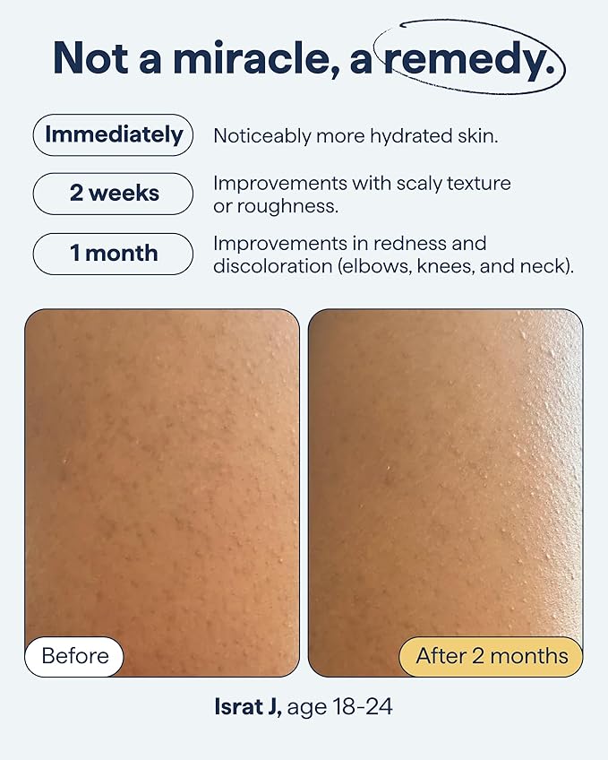 KP Exfoliating Body Moisturizer