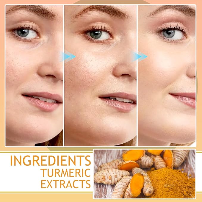 Turmeric