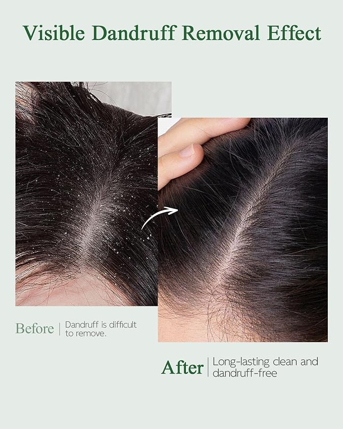 Scalp Essence