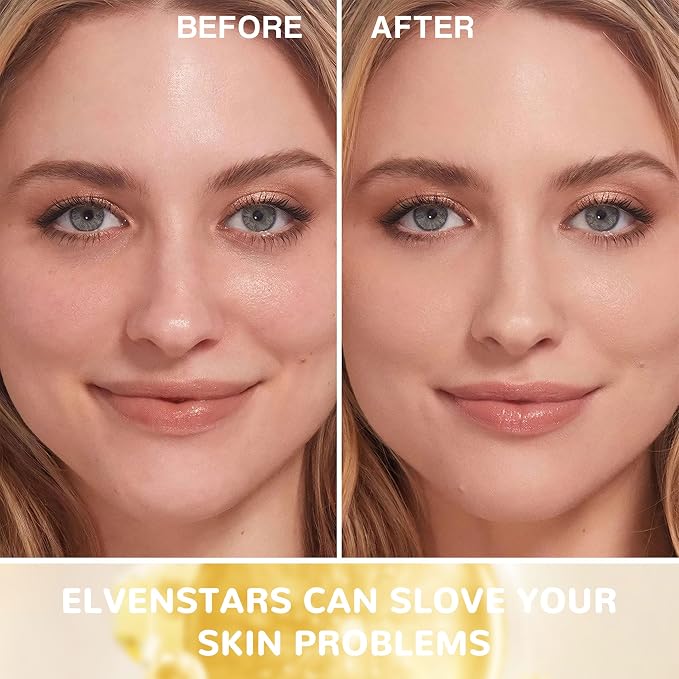 Collagen
