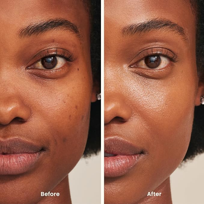 Medium with Neutral Undertones