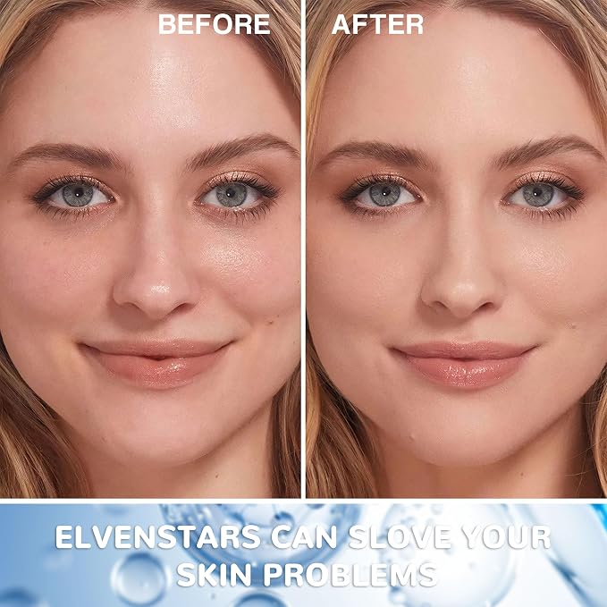 Hyaluronic acid
